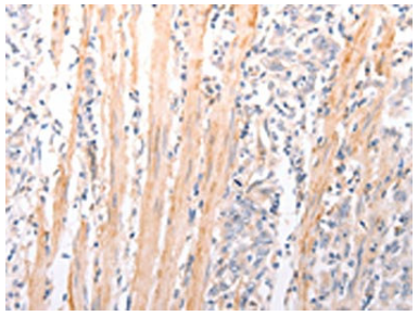 [AFG Scientific] ABCA2 Antibody