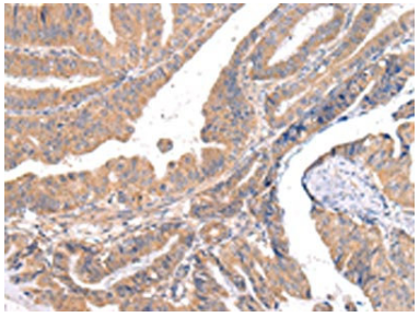 [AFG Scientific] ABCC1 Antibody