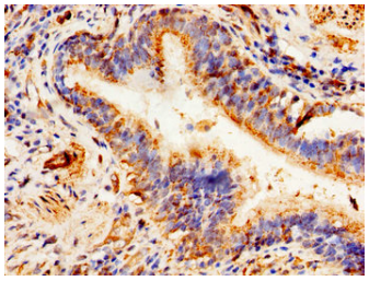 [AFG Scientific] ABCD1 Antibody