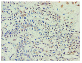 [AFG Scientific] ABCE1 Antibody