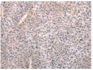[AFG Scientific] ABCF1 Antibody