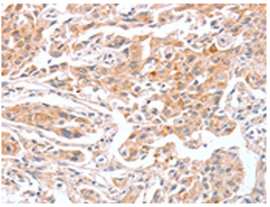 [AFG Scientific] ABO Antibody