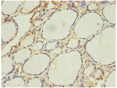 [AFG Scientific] ACAA1 Antibody