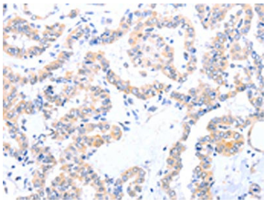 [AFG Scientific] ACAD10 Antibody