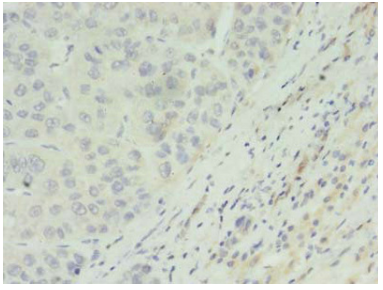 [AFG Scientific] ACADL Antibody