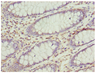 [AFG Scientific] ACADM Antibody