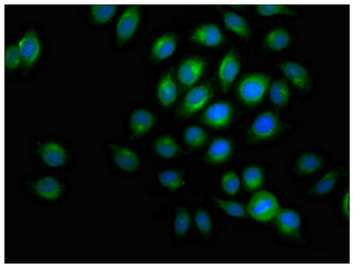 [AFG Scientific] ACADVL Antibody