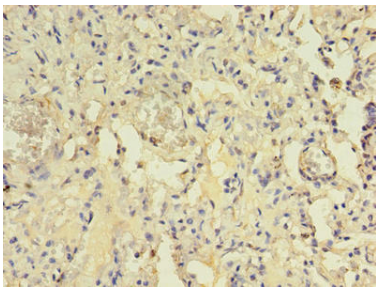 [AFG Scientific] ACAP1 Antibody