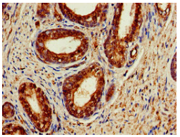 [AFG Scientific] ACAT1 Antibody