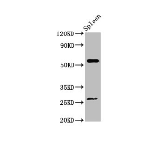 [AFG Scientific] ACD Antibody