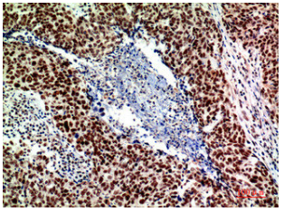 [AFG Scientific] ACER2 Antibody