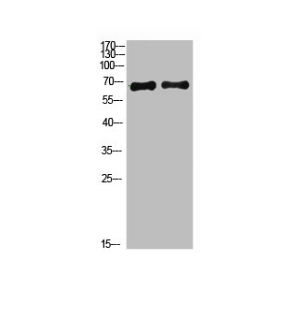 [AFG Scientific] Acetyl-ACSS1 (K642) Antibody