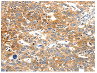 [AFG Scientific]  SCN5A Antibody