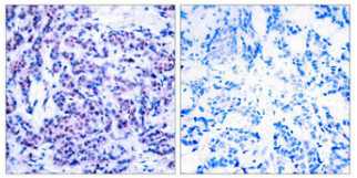 [AFG Scientific] Phospho-JUND (Ser255) Antibody