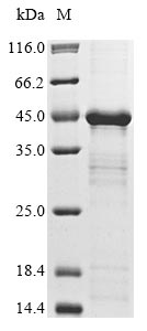 [Cusabio] Recombinant Porphyromonas gingivalis Lys-gingipain HG66 (kgp), partial