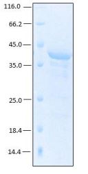 [Rekom Biotech] Recombinant antigen VlsE for Borrelia garinii, Borrelia afzelii and Borrelia burgdorferi 