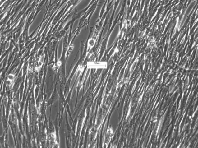 [Vitro Biopharma] Human Lung Squamous Cell Carcinoma Cancer-Associated Fibroblasts (CAFs): 1,000,000 Cells