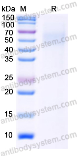 [Antibodysystem] Recombinant Monkeypox virus/MPXV HA/B2R Protein, C-His