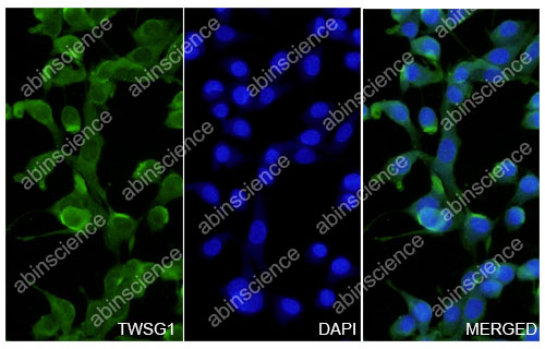 [Abinscience] Anti-TWSG1 Polyclonal Antibody (HV536014)