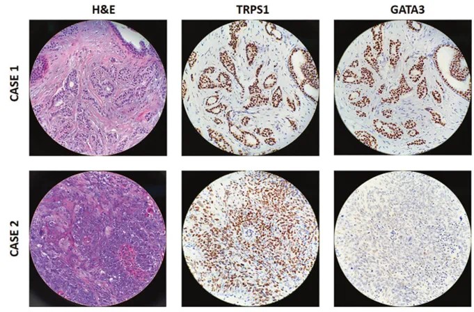 [Celnovte] TRPS1 Immunohistochemistry primary antibody,anti-rabbit,monoclonal, EPR16171