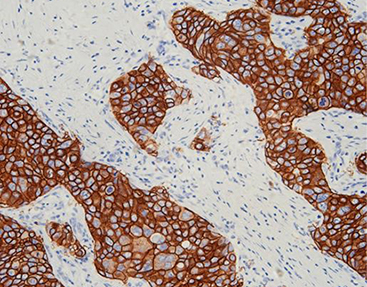 [Celnovte] C-erB-2 Oncoprotin(HER2)