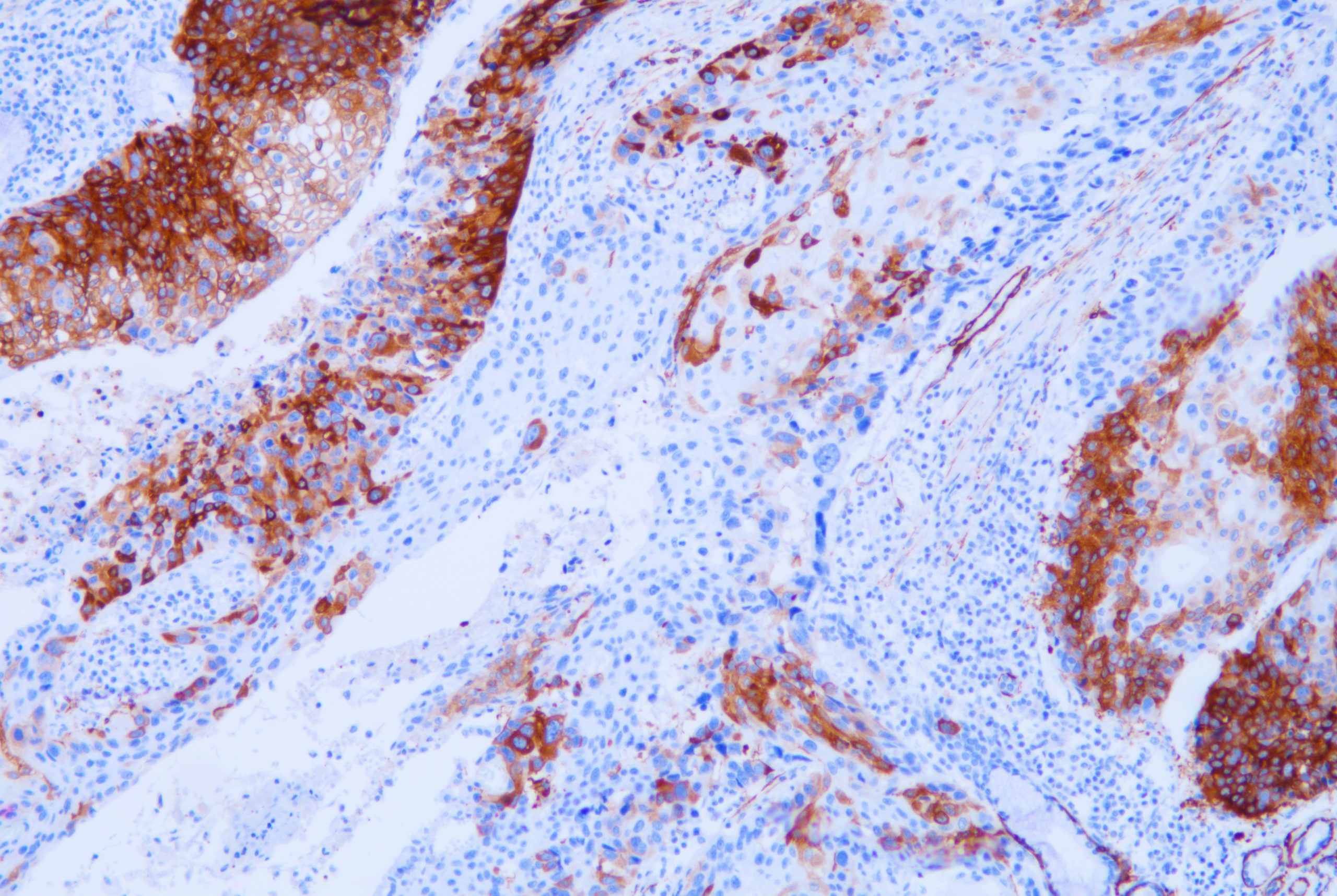 [Celnovte] Myosin Heavy Chain (MHC)