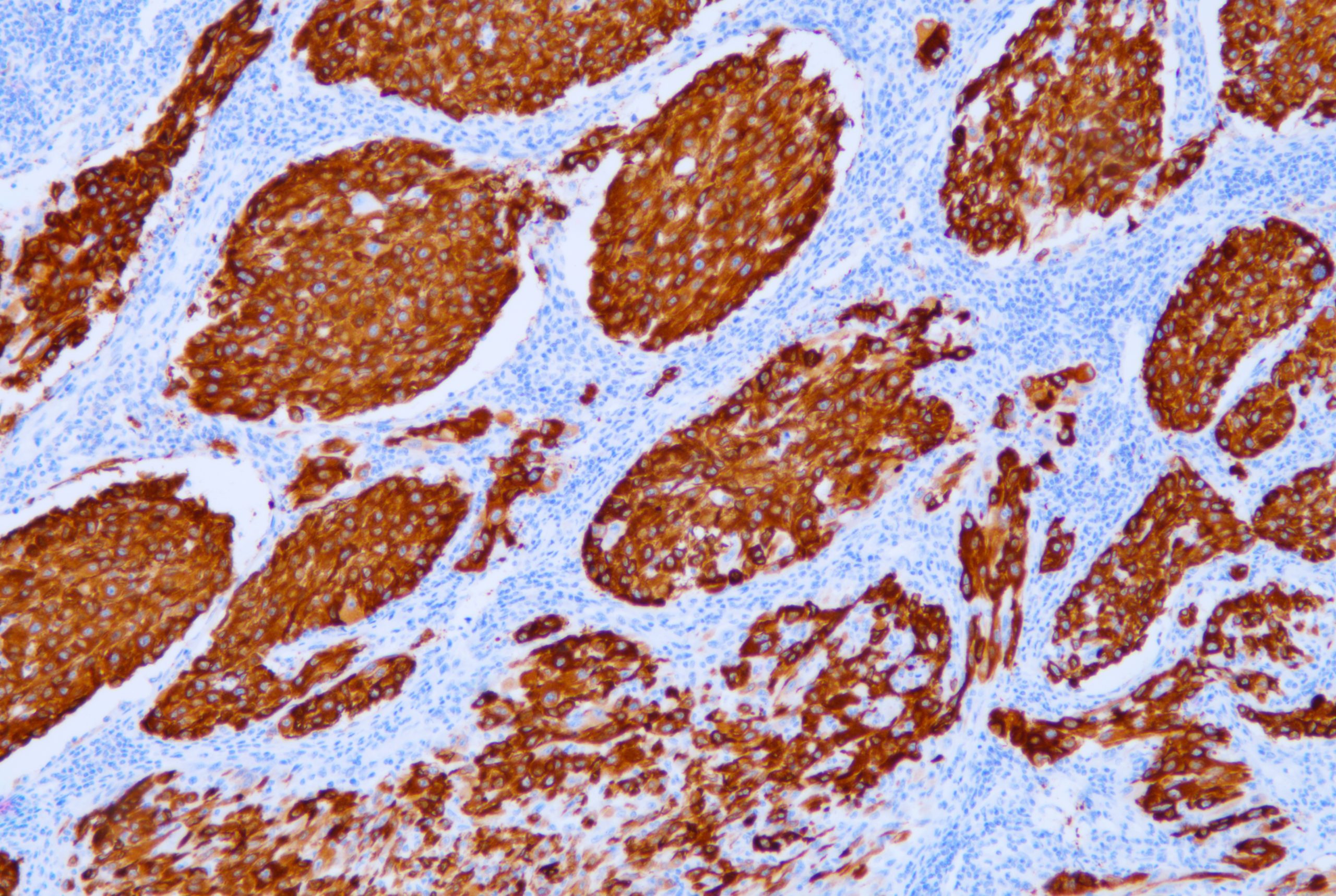[Celnovte] Melanoma Marker(CD63)