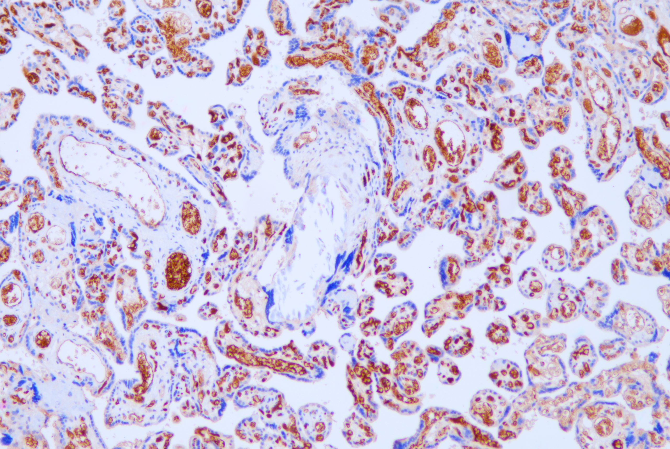 [Celnovte] Alpha Fetoprotein(AFP)