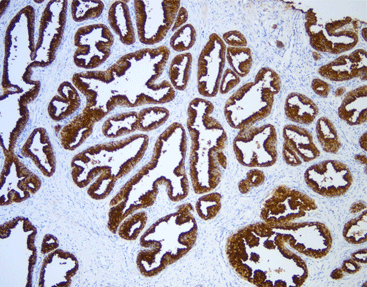 [Celnovte] Prostate Specific Antigen (PSA)