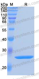 [Antibodysystem] Recombinant Human HMGB1 Protein, C-His (Active)