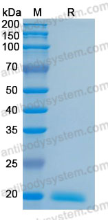 [Antibodysystem] Recombinant Human IL28A/IFNL2 Protein, C-His (Active)