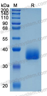 [Antibodysystem] Recombinant Human CD85f/LILRA5 Protein, C-His (Active)