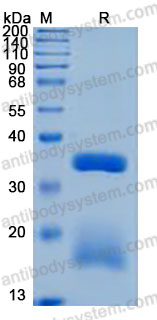 [Antibodysystem] Recombinant Human RGMB Protein, C-His (Active)