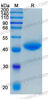 [Antibodysystem] Recombinant Human ANGPTL7 Protein, C-His (Active)