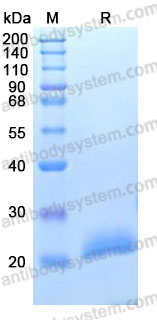 [Antibodysystem] Recombinant Human PGLYRP1/PGRPS Protein, C-His (Active)