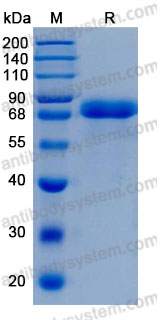[Antibodysystem] Recombinant Human A1BG Protein, C-His (Active)