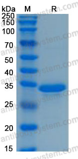 [Antibodysystem] Recombinant Human IGFBP1 Protein, C-His (Active)