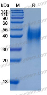 [Antibodysystem] Recombinant Mouse LIF Protein, C-His (Active)