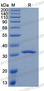 [Antibodysystem] Recombinant Human CSH1 Protein, C-His (Active)
