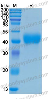 [Antibodysystem] Recombinant Human TFPI Protein, C-His (Active)