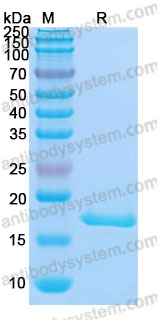 [Antibodysystem] Recombinant Mouse IL1B/IL1F2 Protein, C-His (Active)