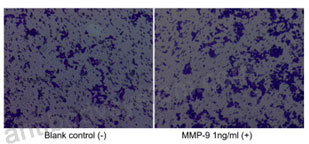 [Antibodysystem] Recombinant Human MMP9 Protein, C-His (Active)