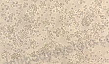 [Antibodysystem] Recombinant Human CD31/PECAM1 Protein, C-His (Active)