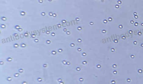 [Antibodysystem] Recombinant Human CD326/EPCAM Protein, C-His (Active)