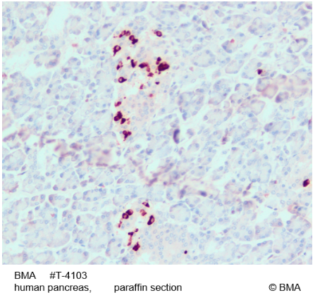 [BMA BIOMEDICALS] Rabbit anti Somatostatin-14