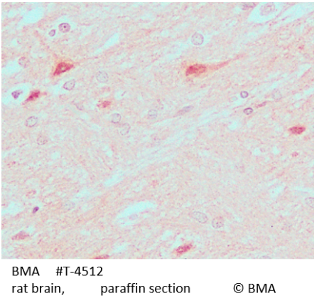 [BMA BIOMEDICALS] Rabbit anti pTH-related protein (1-34) (human, rat)