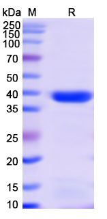 [Proteogenix] Monkeypox virus/MPXV A35R Recombinant Protein, N-GST & C-His