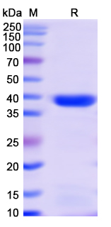 [Proteogenix] Monkeypox virus/MPXV A29L Recombinant Protein, N-GST & C-His