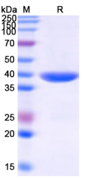 [Proteogenix] Monkeypox virus/MPXV B16R Recombinant Protein, N-His