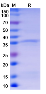 [Proteogenix] Recombinant Monkeypox virus/MPXV B5R Protein, N-His